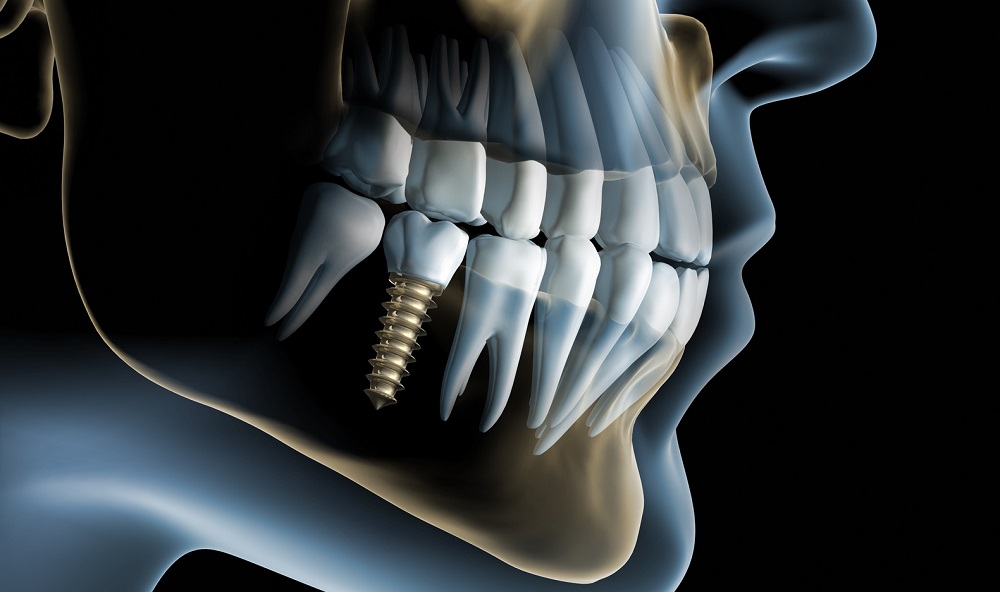 ağız çene ve diş cerrahisi antakya