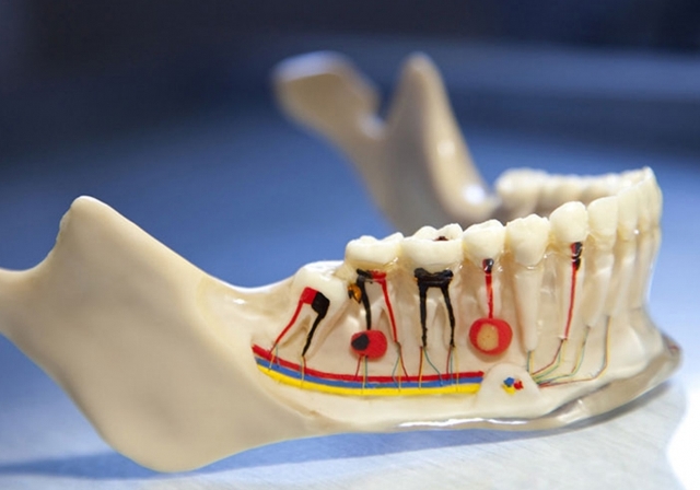 Antakya kanal tedavisi fiyatları