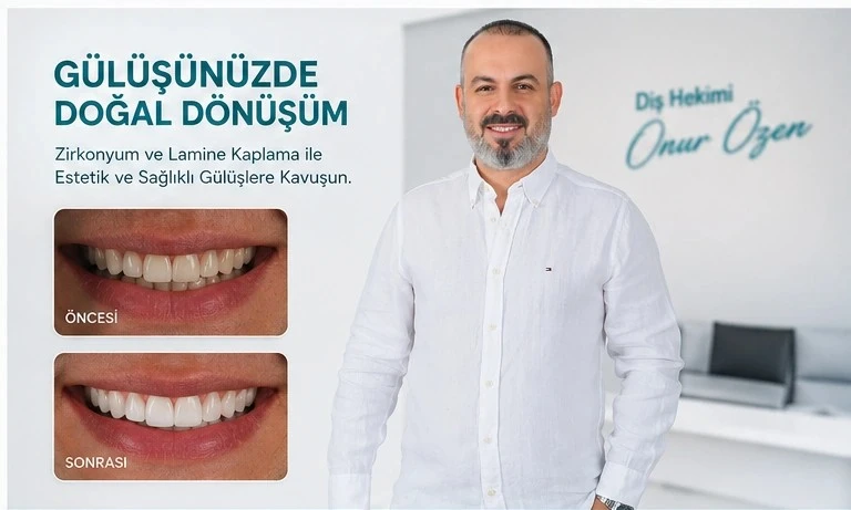 Antakya zirkonyum diş kaplama fiyatları