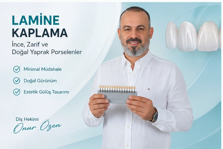 lamine kaplama (yaprak porselen) diş antakya