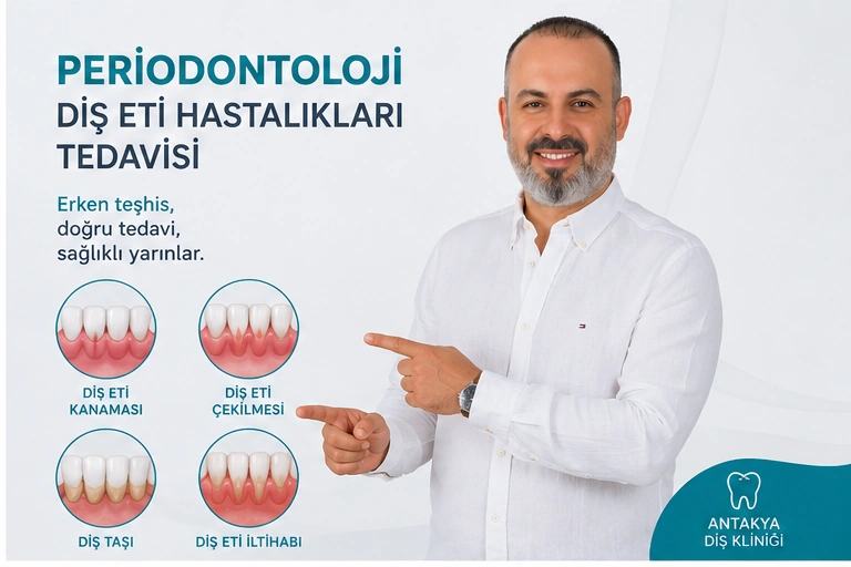 periodontoloji uzmanı Antakya
