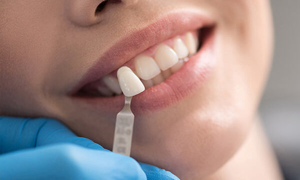 antakya zirkonyum diş kaplama